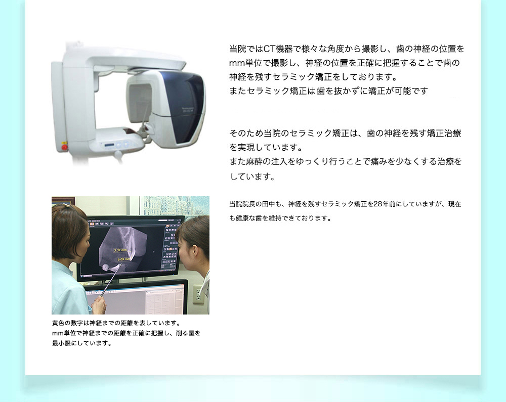 当院では、最新のCT機器で様々な角度から撮影し、歯の神経の位置をmm単位で撮影し、神経の位置を正確に把握することで歯の神経を残すセラミック矯正をしております。またセラミック矯正は歯を抜かずに矯正が可能です。そのため当院のセラミック矯正は、歯の神経を残す矯正治療を実現しています。また麻酔の注入をゆっくり行うことで痛みを少なくする資料をしています。当院理事長の田中も、神経を残すセラミック矯正を28年前にしていますが、現在も健康な歯を維持できております。